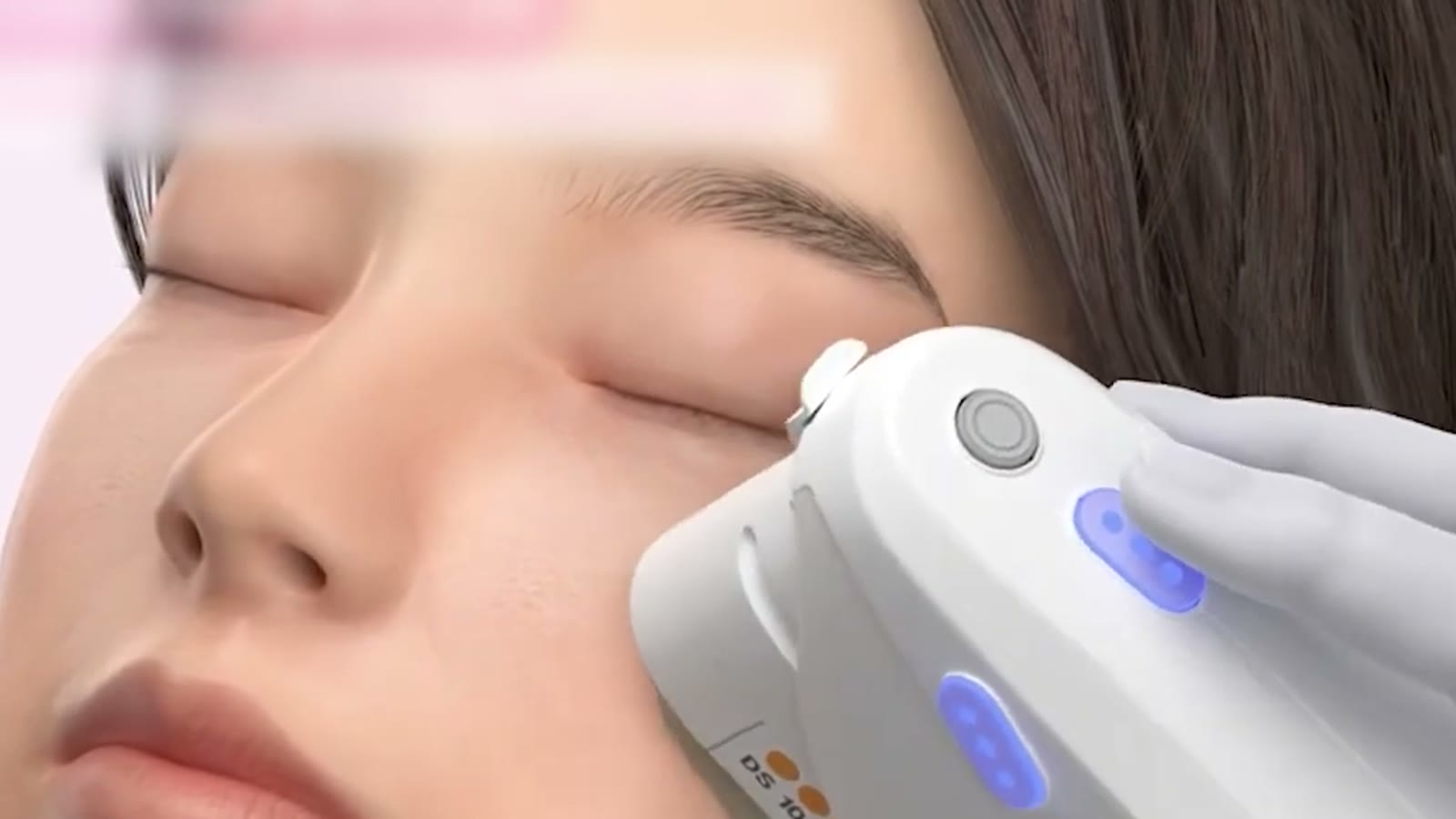 リフティング施術後、効果を保つケアの正しい順番